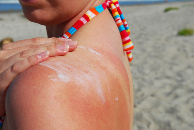 Sonnenbräune Haut Gefahr Hautkrebs Schutz Sonnenbrand