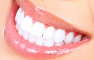 Weiße Zahnverfärbungen