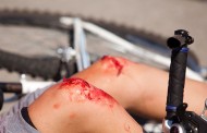 Keine Angst wenn Blut fließt – Verletzungen selbst behandeln