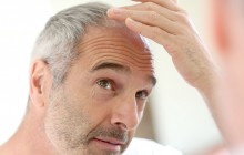Haarausfall, woher kommt das und was kann man dagegen tun?