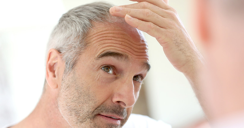 Haarausfall, woher kommt das und was kann man dagegen tun?