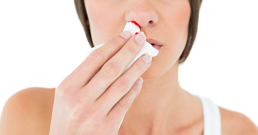 Richtiges Verhalten bei Nasenbluten