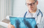 Tuberkulose – früher gefürchtet, heute heilbar