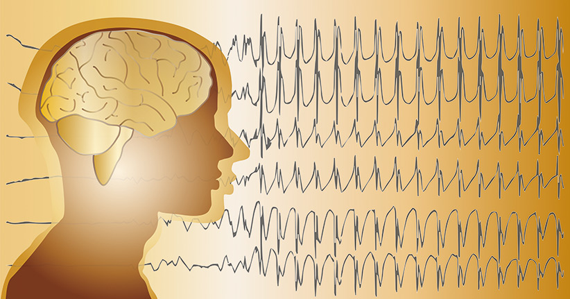 Wie gefährlich ist Epilepsie?