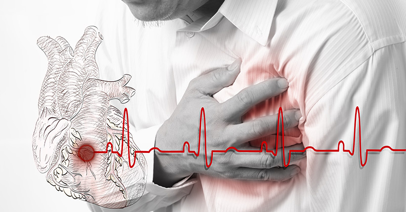 Herzinfarkt – Was gilt zu beachten?