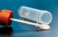 Blut im Stuhl – nicht immer ein Alarmsignal