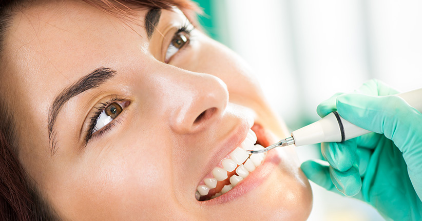 Lohnt sich eine professionelle Zahnreinigung wirklich?