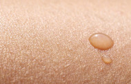 Rosacea - eine weitverbreitete Hautkrankheit