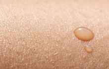 Rosacea - eine weitverbreitete Hautkrankheit