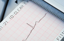 Elektroschocks - schnelle Hilfe bei Herzrhythmusstörungen