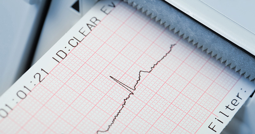 Elektroschocks - schnelle Hilfe bei Herzrhythmusstörungen