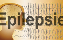 Epilepsie im Kindesalter