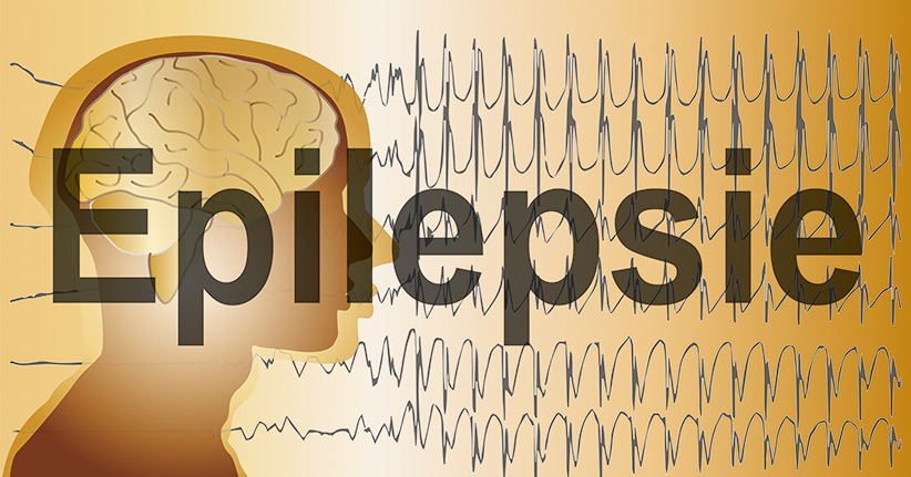 Zusammenhang zwischen Epilepsie und Wetter