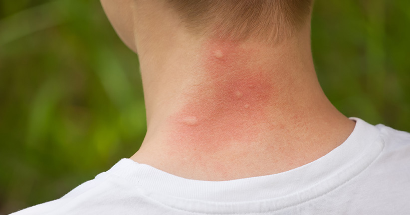 Was macht Menschen für Mücken unwiderstehlich?