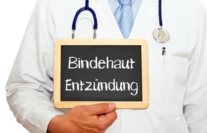 Bindehautentzündung – Ursachen und Behandlung