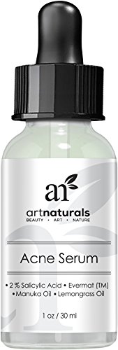 Art Naturals® Anti-Akne Serum Behandlung 30 ml, Dermatologisch getestetes Produkt | Hergestellt aus revolutionärem Evermat® & organischen Inhaltsstoffen | helfen gegen Akne | Bester Poren Minimierer | Ideal für alle Hauttypen & Altersgruppen