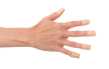 Effektive Tipps gegen das Nagelkauen