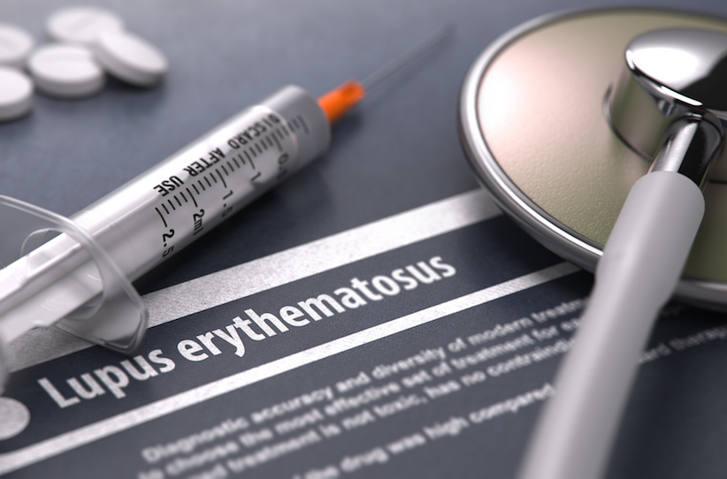 Lupus erythematodes – Schmetterlingsflechte Autoimmunkrankheit