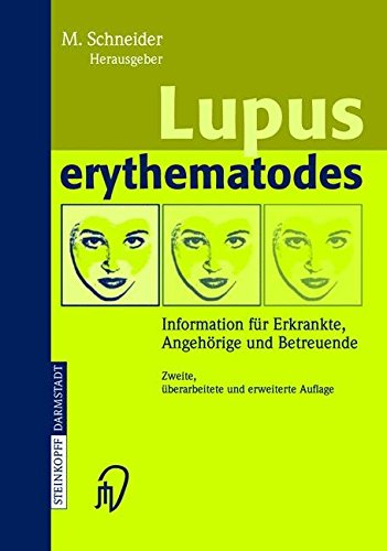 Lupus erythematodes: Information Für Erkrankte, Angehörige Und Betreuende (German Edition)