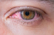 Augenbrennen: Wie entsteht es und was hilft dagegen?