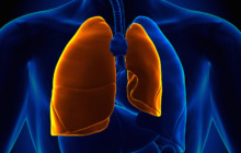 Pneumothorax / Spannungspneumothorax, Lungenkollaps