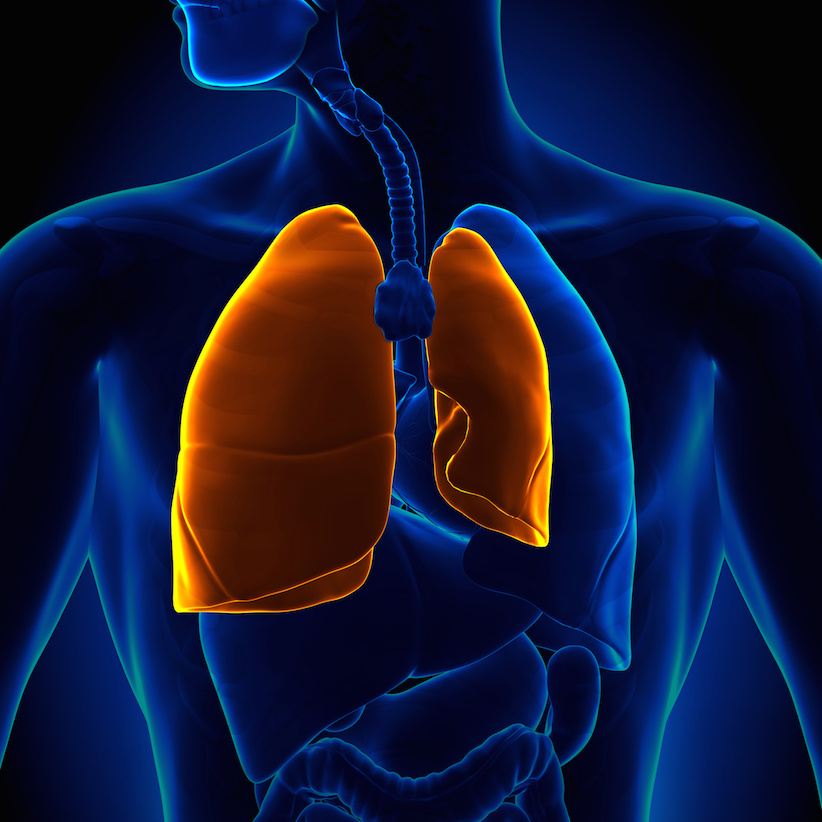 Pneumothorax