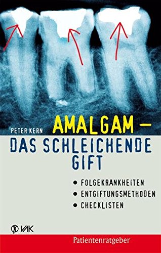 Amalgam - das schleichende Gift. Folgekrankheiten, Entgiftungsmethoden, Checklisten