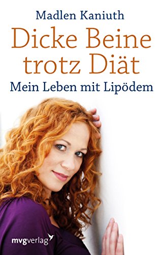 Dicke Beine trotz Diät: Mein Leben mit Lipödem