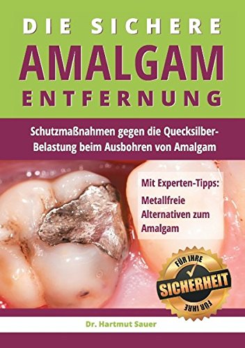 Die sichere Amalgam-Entfernung: Schutzmaßnahmen gegen die Quecksilber-Belastung beim Ausbohren von Amalgam