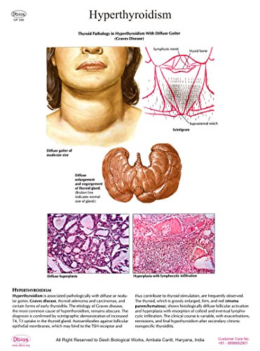 Dbios Digitaldruck Wall Poster Hyperthyreose Wandbildungswandtafeln