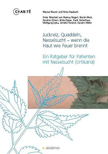 Juckreiz, Quaddeln, Nesselsucht - wenn die Haut wie Feuer brennt: Ein Ratgeber für Patienten mit Nesselsucht (Urtikaria) (Patientenratgeber)