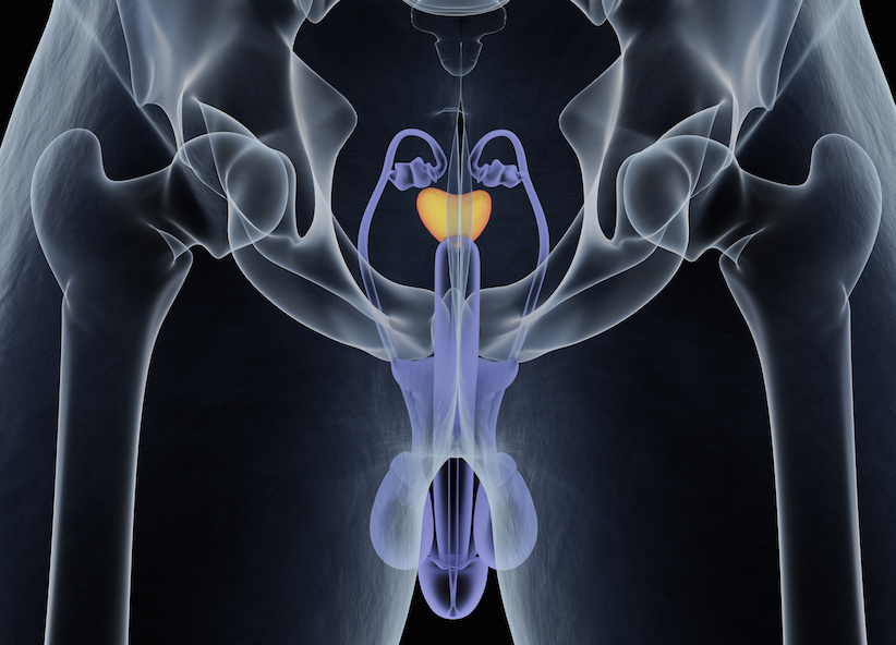 prostataoperation erektionsprobleme therapie hilfe