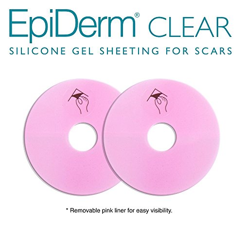 EpiDerm transparentes Silikon Narbenpflaster Areola Kreise (1x2 Stück) für die Brust / transparente Silikonfolie gegen Narben nach Brustoperation
