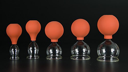 5er Schröpfglas-Set mit Ball 25-35-45-55-60mm zum professionellen, medizinischen, feuerlosen Schröpfen, Schröpfglas, Schröpfgläser, Lauschaer Glas das Original