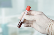 Cholesterin lässt Tumor deutlich schneller wachsen
