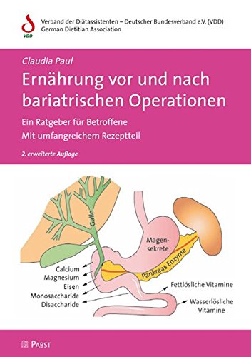 Ernährung vor und nach bariatrischen Operationen: Ein Ratgeber für Betroffene • Mit umfangreichem Rezeptteil